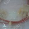 853-385317-001 | ASSY,CA,PLC INTLK,A/L